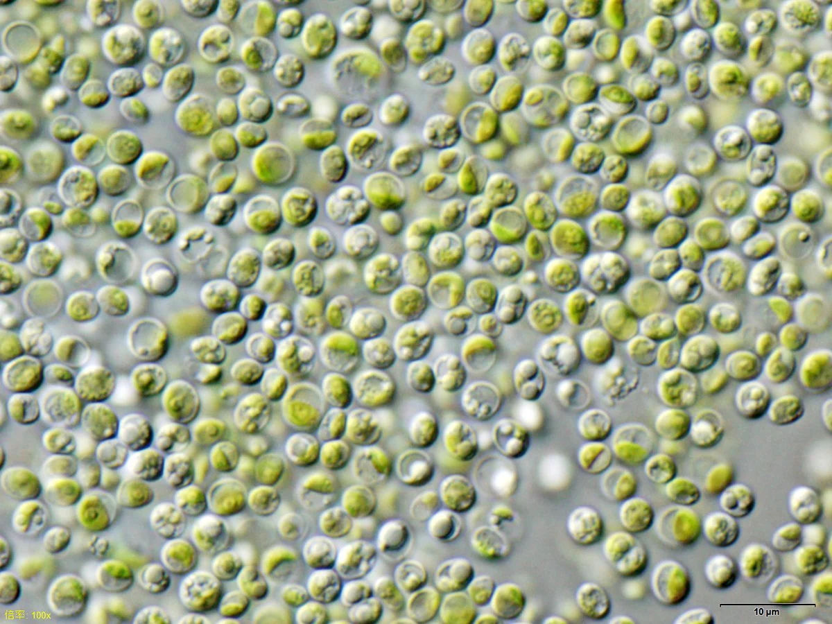 Хлорела (Chlorella vulgaris) — реална микрофотография